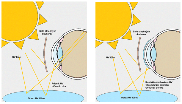 UV filter